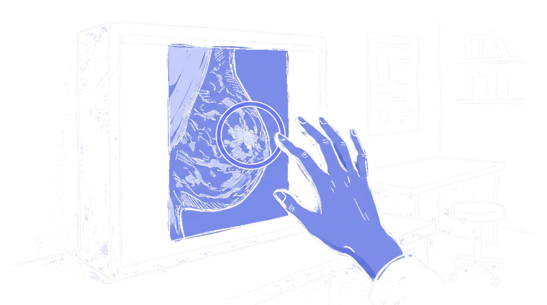 Skizze Mammogramm mit KI-Overlay (Dark)